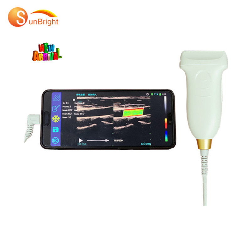 factory price wireless portable color doppler ultrasound portable usb probes ultrasound for sale