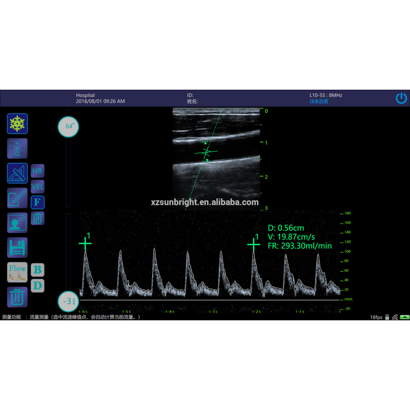 Ob Gyn Medical Sonar Portable scanner Ultrasound System linear transducer