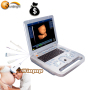 OB GYN USG probe pregnant transvaginal convex 15 inches portable ultrasound machine 3D