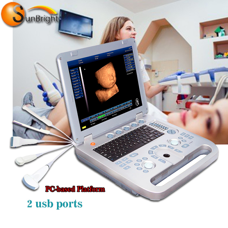 High quality portable full digital diagnostic black and white ultrasound factory in china