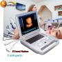 High quality portable full digital diagnostic black and white ultrasound factory in china