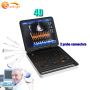High performance color doppler scan medical 3D cheap ultrasound machine for sale