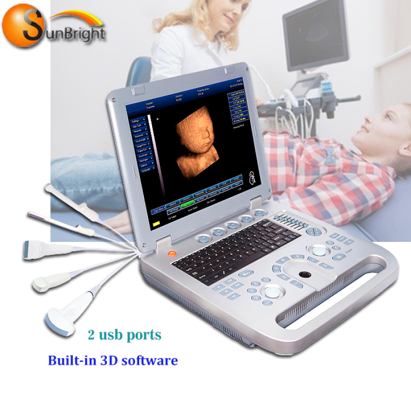 Popular selling ecografo 3D 4D portable pregnancy test ultrasound price convex probe