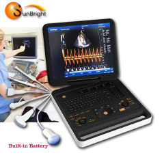 vascular doppler portable hot selling laptop 4D ultrasound medical equipmentchine