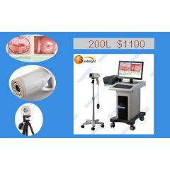 colposcope for gynecology fully digital Sony Camera SUN-200L/china digital colposcope
