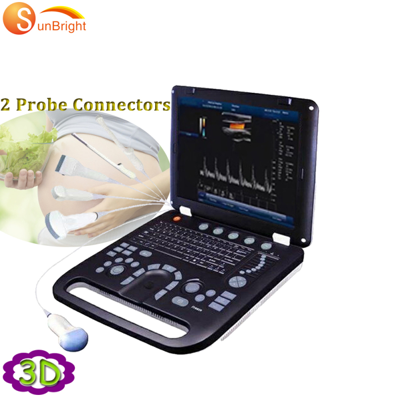 Macchina per ultra scansione medica ospedaliera 3D con ultrasuoni a colori per laptop con sonda convessa