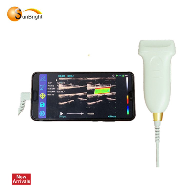 SUN-D2 Mini USG الهاتف الذكي USB الخطي اللون دوبلر مسبار الجيب الموجات فوق الصوتية للهاتف