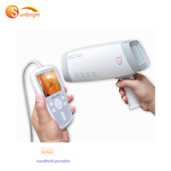 Cámara de colposcopio de video electrónico digital directo a la pantalla para ginecología