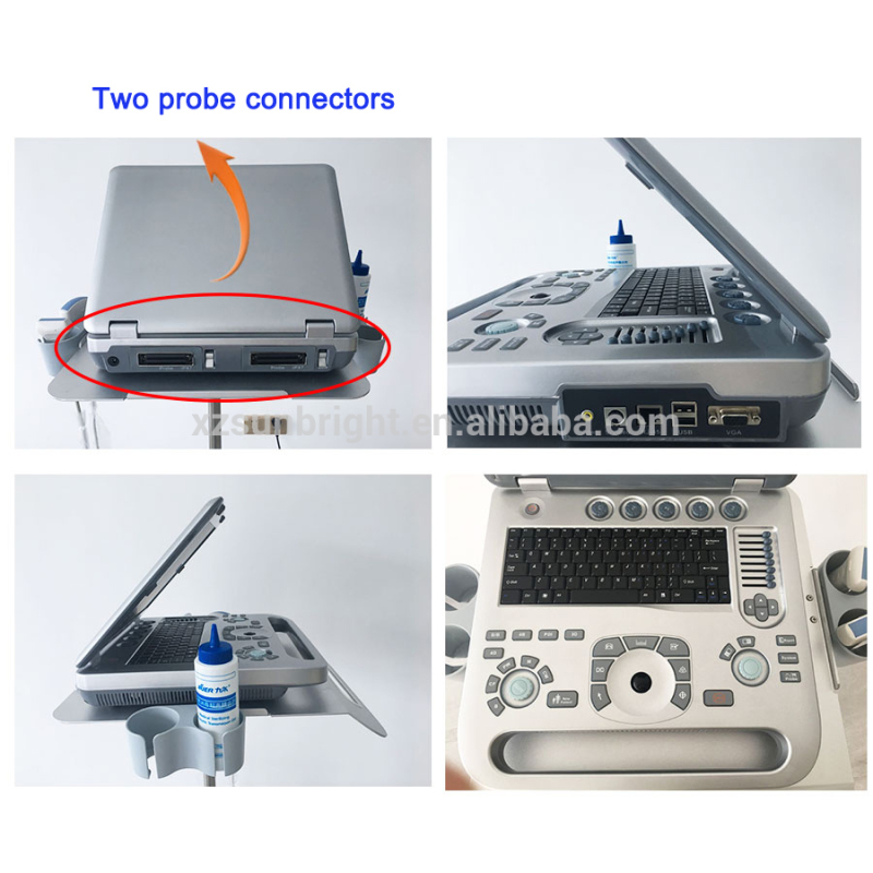 OB Urology Gynecology Digital Color Doppler Diagnostic ultrasonido 4d ecografo portatil ginecologico