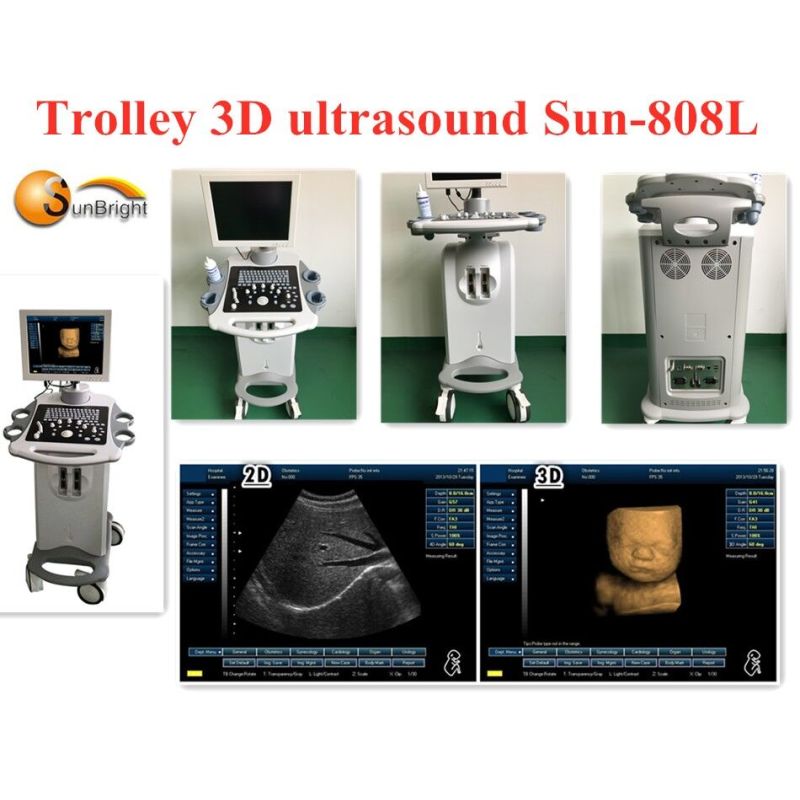 초음파 트롤리 새로운 도착 심장 전문의는 의학 트롤리 3D 초음파 스캐너 SUN-808L를 사용했습니다