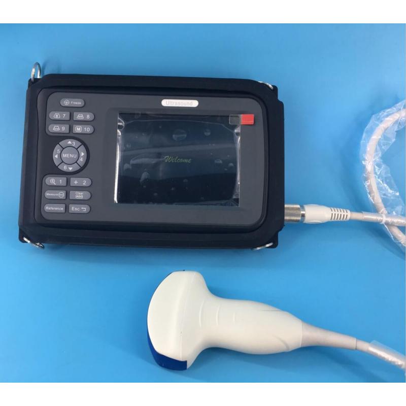 Cardiac 2D handheld ultrasound echocardiography ultrasound echo machine price