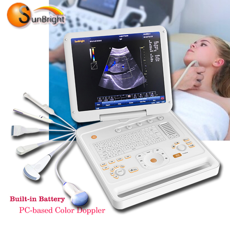 근골격 초음파 기계 4d 의료 기기
