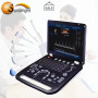 Sun-906B 3D 4D color Doppler Sistema diagnostico per computer portatile macchina per ecografia cardiaca portatile iphone
