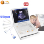 Portable 15 Inches Colour Ultrasound Doppler Cardiac Vascular Ultrasound Equipment With Phase Probe