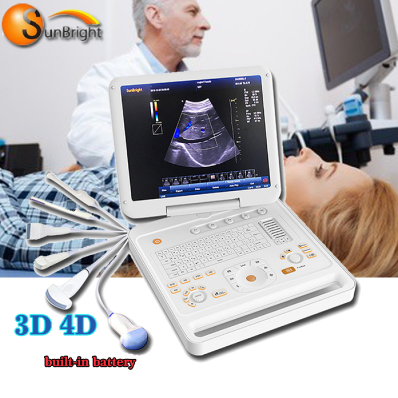 جهاز كمبيوتر محمول لتصوير الأوعية الدموية بالموجات فوق الصوتية ثلاثي الأبعاد دوبلر ملون ماكينة طبية تعمل بالموجات فوق الصوتية بسعر منخفض