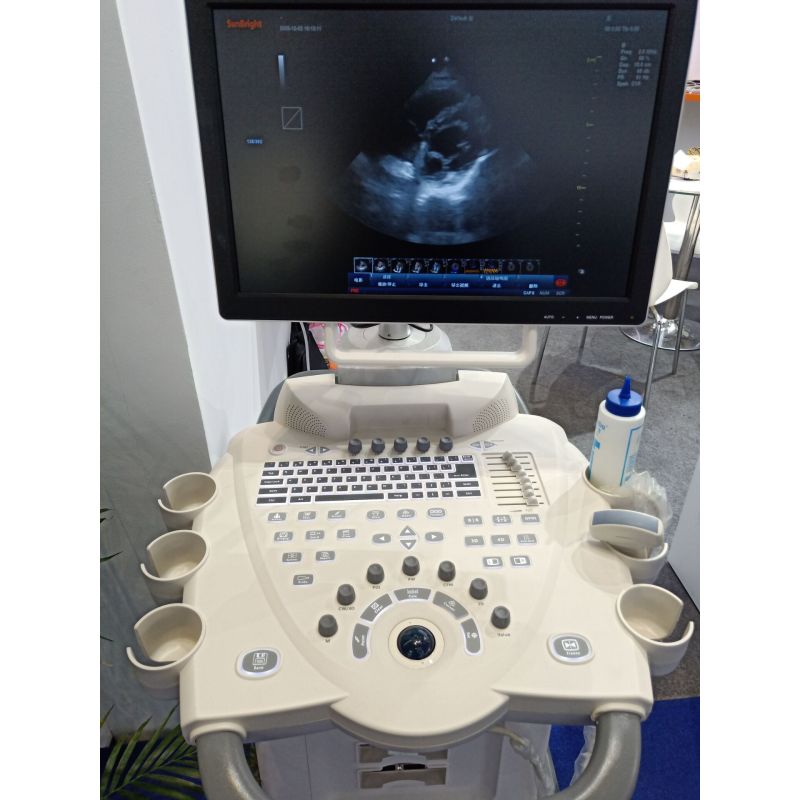 trolley cart portable ultrasound Color Doppler vscan