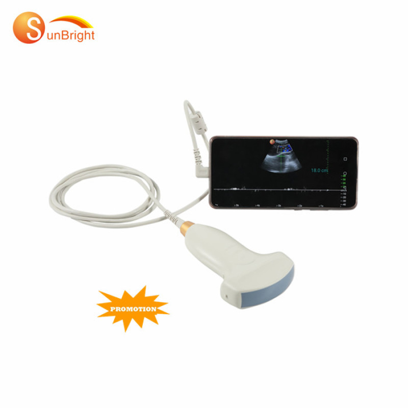 portable advanced hospital direct manufacturer usb mobile phone ultrasound probe