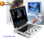 BW cheap laptop echo cardiac ultrasound machine price SUN-806H