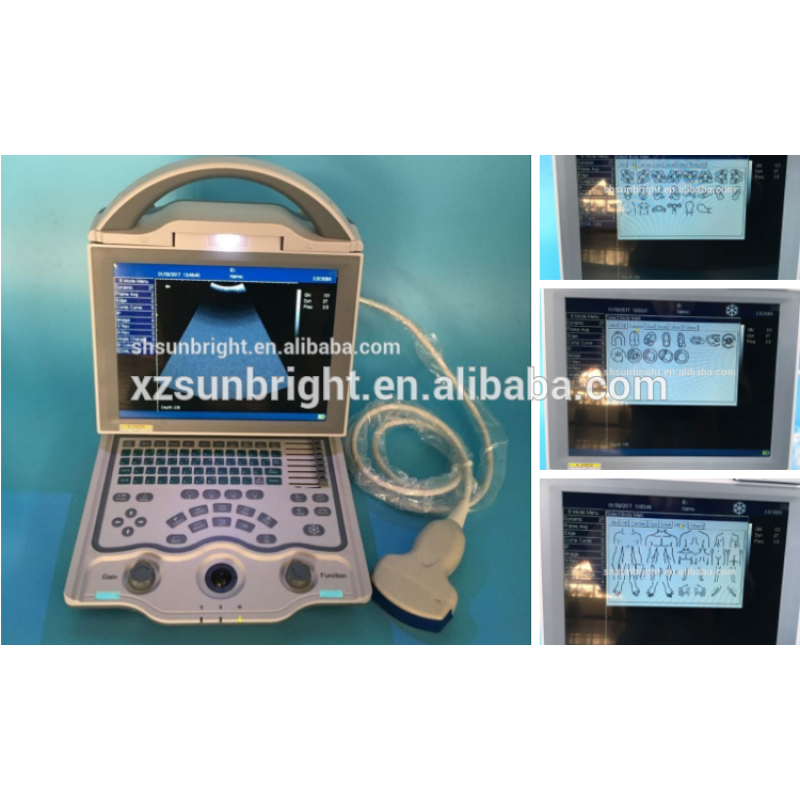 New upgraded Portable Diagnostic Ultrasound Pig horse sheep dog ultrasound machine