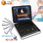 Big promotion portable echograph good quality 3D 4D color Doppler ultrasound machine with CW PW system