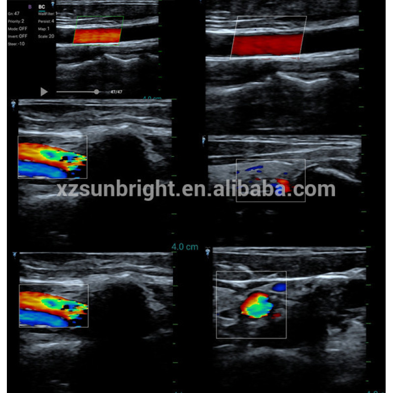 High quality vascular 128 elements ultrasound wireless USB probe ultrasound scanner linear color doppler