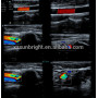 High quality vascular 128 elements ultrasound wireless USB probe ultrasound scanner linear color doppler