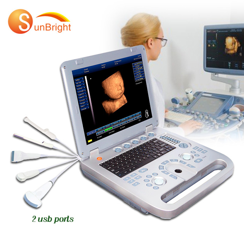 portable 3D cardiac vascular Obstetrics ultrasound pregnancy convex