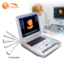 portable 3D cardiac vascular Obstetrics ultrasound pregnancy convex