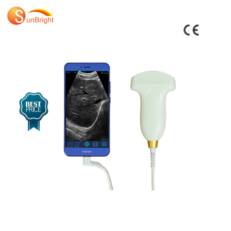 pw wireless phone use Ultrasound Scanner probe SUN-P1