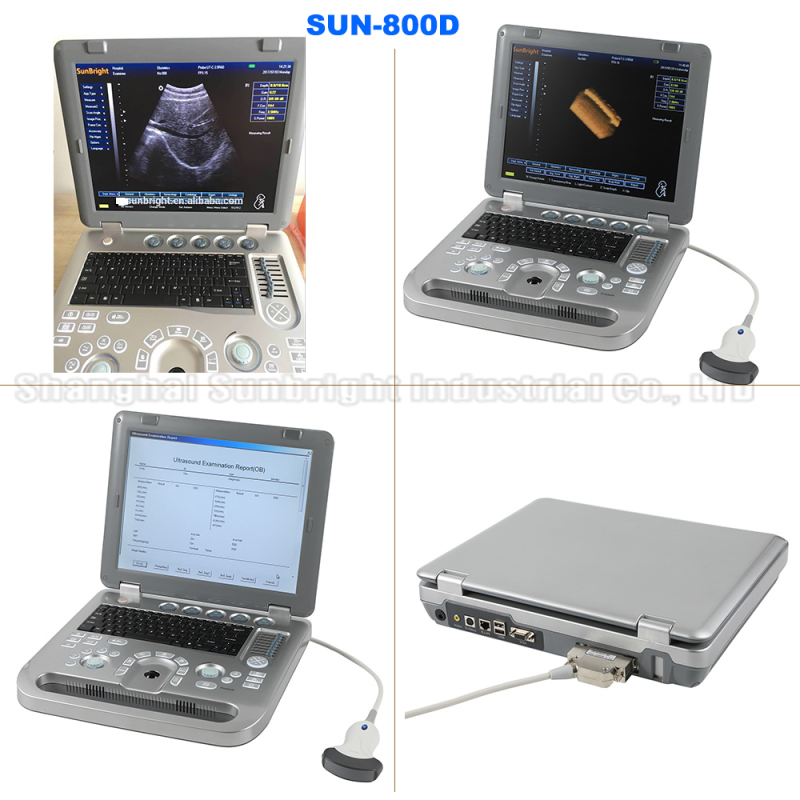 High intensity laptop hospital BW 3D OB GYN medical color ultrasound scanner machine