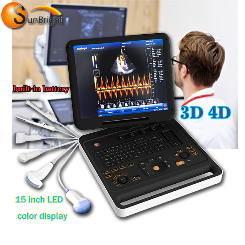 laptop 3D colour ultrasound medical scanner