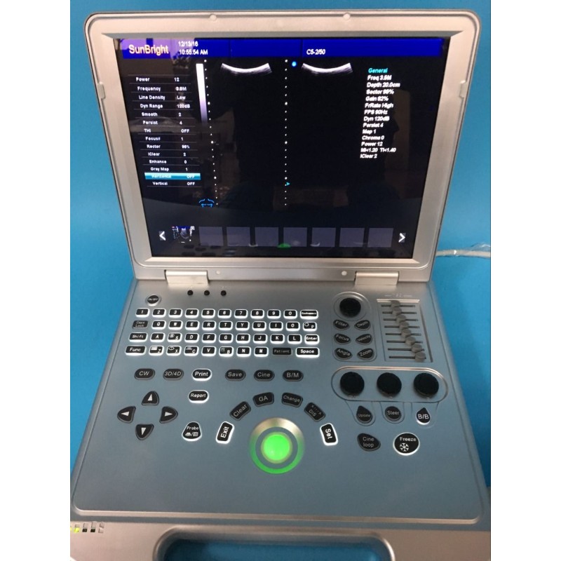 Hospital 3D 4D laptop color doppler ultrasound SUN-906S