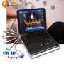 CE ISO Approval Portable Laptop Color Doppler 3D/4D CW Ultrasound machine System Machine Factory Price