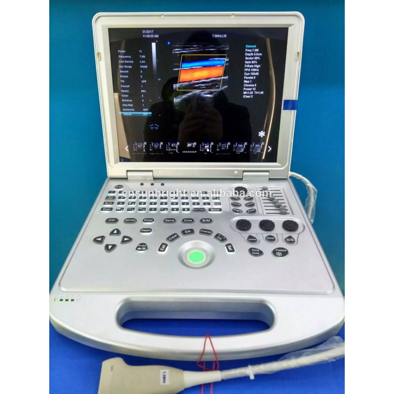 popularity priced hospital used color doppler ultrasound for sale