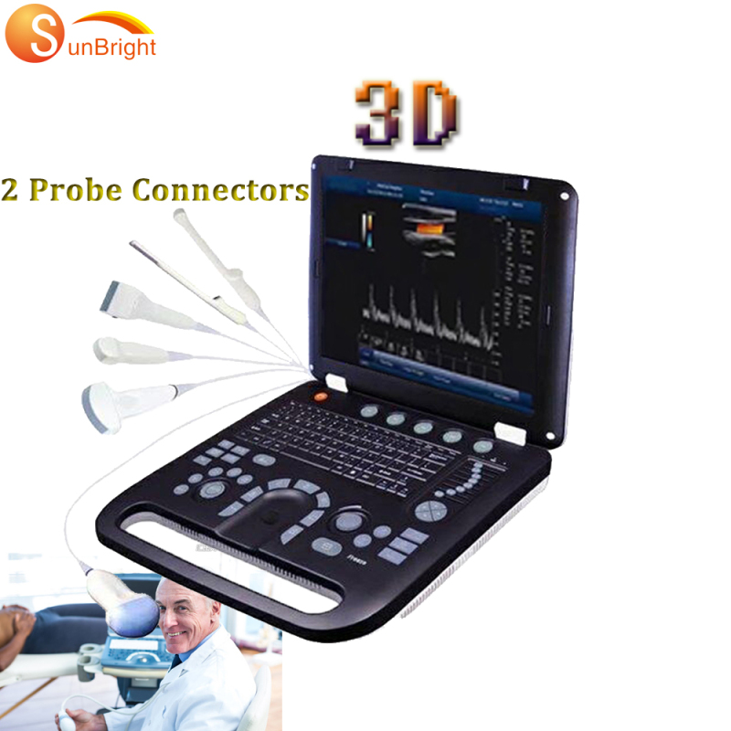 3D-медичне кольорове доплерівське сканування, ультразвукове дослідження дитини, сонограма, апарат