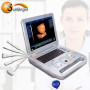 High quality similar ge logiq ultrasound machine 3 probe