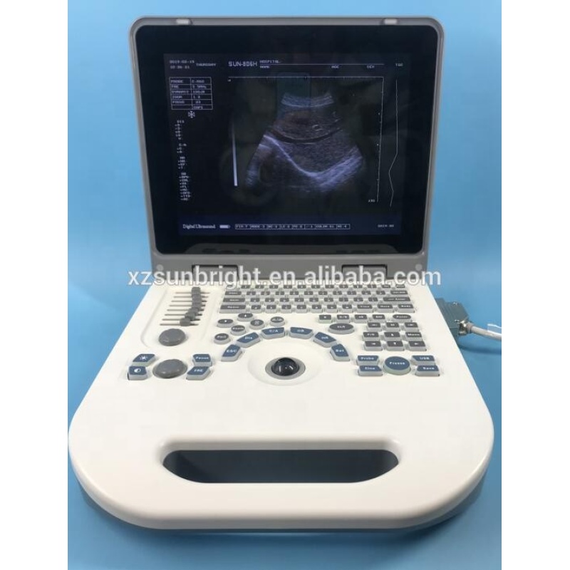 Factory low price cheapest 3D laptop ultrasound machine price