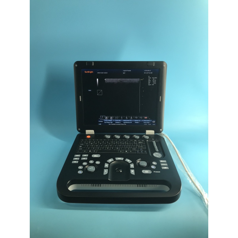 Newest 3D 4D laptop color doppler ultrasound diagnostic system Sun-906B machine