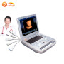 Sales champion 3D ultrasound scanner with portable diagnostic ultrasound system
