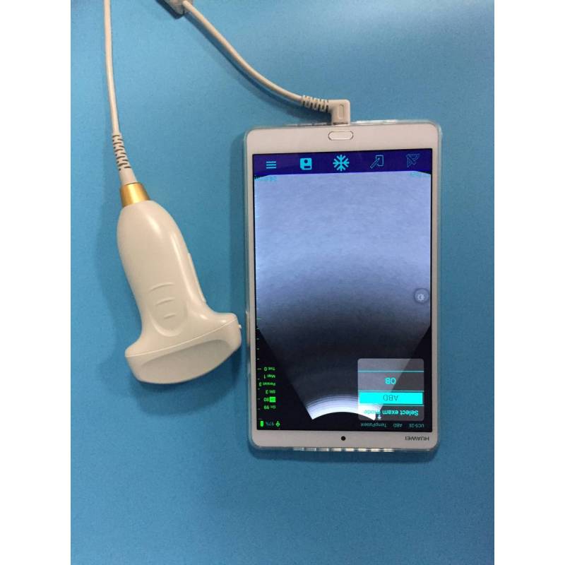 High Resolution Pocket Color Ultrasound Device Mini Handheld probe for ultrasound wireless