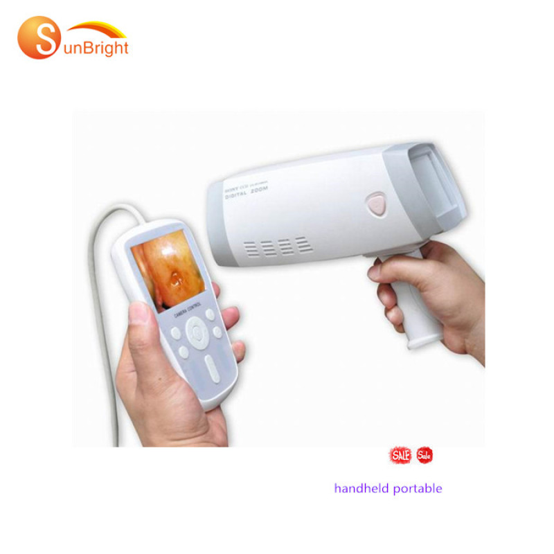 Colposcopio de video con cámara digital de mano para ginecología SUN-200Y