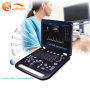 high sensitive medical color doppler cardiac echographe bw ultrasound scanner ultrasound scanner