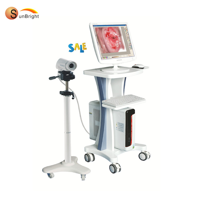 디지털 비디오 질경