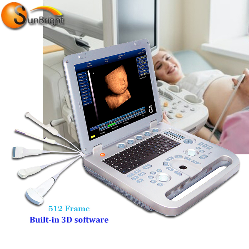 Scanner diagnostico ecografico digitale completo per laptop ad alte prestazioni e costi per donne incinte con funzione 3D