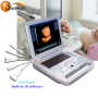Scanner diagnostico ecografico digitale completo per laptop ad alte prestazioni e costi per donne incinte con funzione 3D