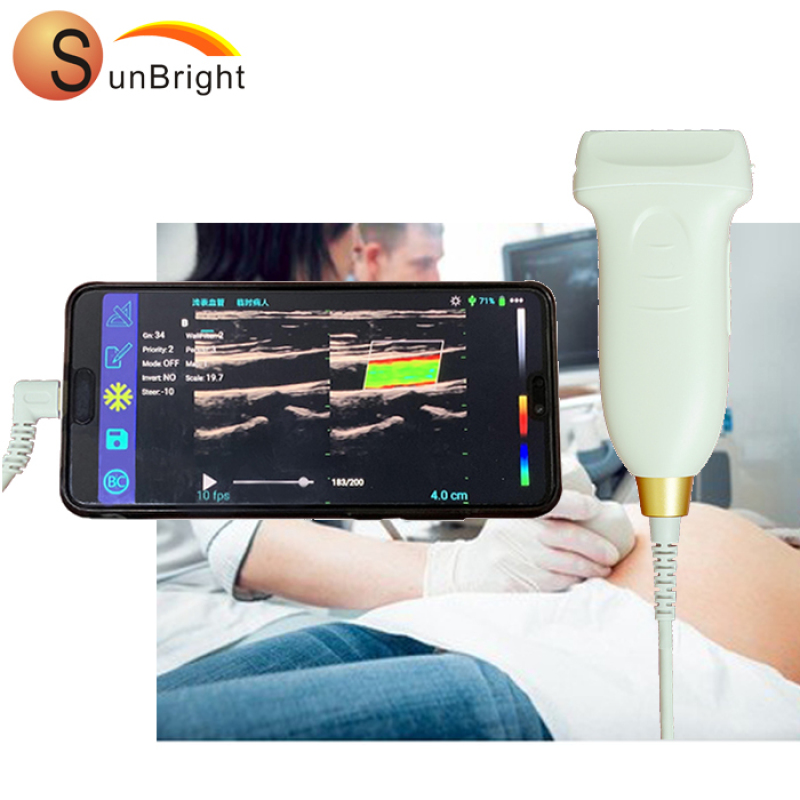 High Quality Latest Portable Smartphone Ultrasound Machine USB Probe Price