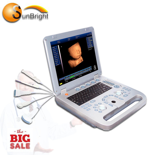 15 inch Full Digital trolley 3D digital Ultrasound Scanner abdominal ultrasound machine