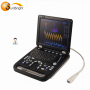 High resolution SUN-906B medical portable 15 inch 4D Digital Color Doppler Ultrasound System B Ultrasound machine