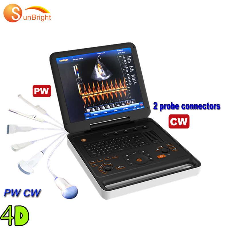 Nuovo arrivo Full Digital eccellente immagine Ultrasuoni doppler per laptop da 15 pollici
