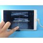 Ecografo a 128 elementi ecografo a sonda lineare USB 2D sunbright per MSK